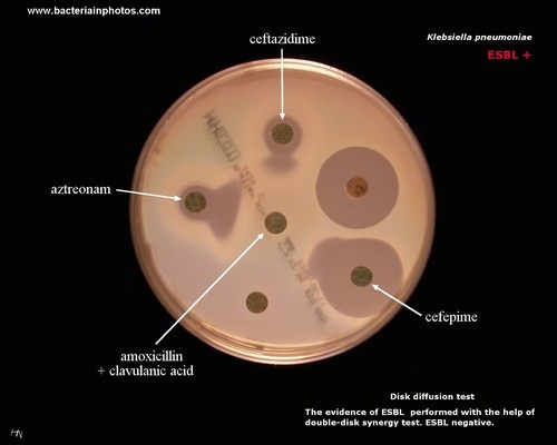 ESBL positive